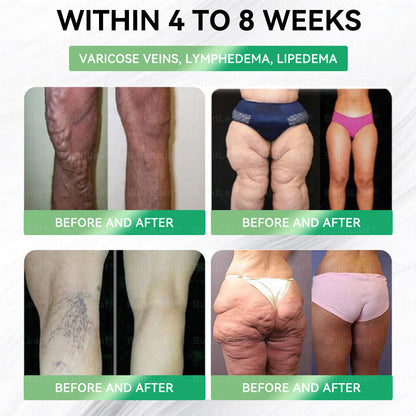 🇬🇧👩‍⚕️🇬🇧80Off% |𝐌𝐇𝐑𝐀 𝐂𝐞𝐫𝐭𝐢𝐟𝐢𝐞𝐝|𝑩𝒖𝒊𝒍𝒅𝑳𝒆𝒂𝒇®𝐒𝐌𝐆𝐓-𝐆𝐋𝐏-𝟏 8-𝐢𝐧-𝟏 𝐏𝐥𝐚𝐧𝐭-𝐏𝐨𝐰𝐞𝐫𝐞𝐝 𝐖𝐞𝐥𝐥𝐧𝐞𝐬𝐬 𝐄𝐥𝐢𝐱𝐢𝐫 | 𝐆𝐞𝐧𝐭𝐥𝐞 𝐃𝐚𝐢𝐥𝐲 𝐒𝐮𝐩𝐩𝐨𝐫𝐭 𝐟𝐨𝐫 𝐁𝐨𝐝𝐲 𝐁𝐚𝐥𝐚𝐧𝐜𝐞, 𝐄𝐧𝐞𝐫𝐠𝐲 & 𝐌𝐞𝐭𝐚𝐛𝐨𝐥𝐢𝐜 𝐇𝐚𝐫𝐦𝐨𝐧𝐲